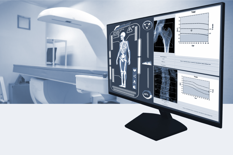 Digitale Knochendiagnostik