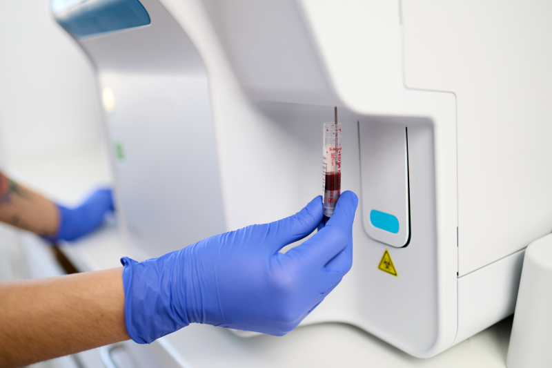 Blutanalyse